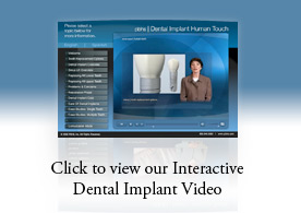 Click here to view our interactive dental implant video.